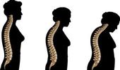 Fotolia_3vr-osteoporsosis-30-15.jpg