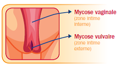bayer-canestin-6-fr.png