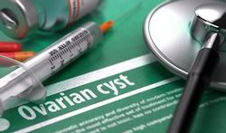 123-ovarium-cysste-Pcos-onvruchtb-02-16.jpg