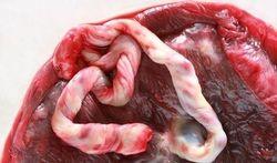 123-placenta-navelstrengbloed-170-01.jpg