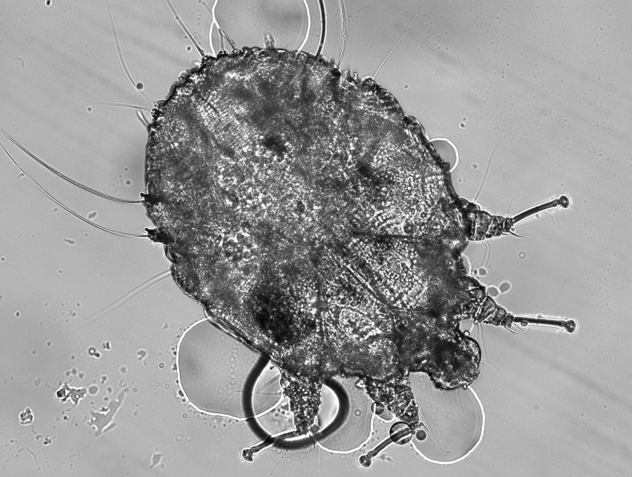 f-wikim-Scabies-12-18.png