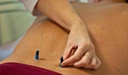 Klein effect acupunctuur bij chronische pijn