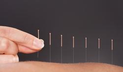 Bouffées de chaleur : l’acupuncture peut vous aider