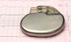 Smartphone kan werking pacemaker beïnvloeden