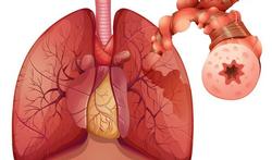 Kent u de 'verborgen' tekenen van astma?