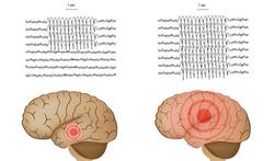 123-anatom-epilepsie-05-17.jpg