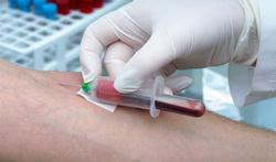 Nieuwe bloedtest helpt reuma te voorkomen