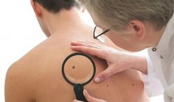 Cancer de la peau : il n'y a pas que le mélanome malin