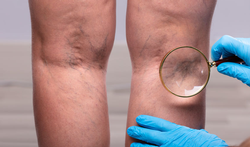 123-dr-oz-aderspet-flebitis-aderontstek-06-19.png