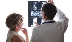 Soorten rugpijn (4): Artrose van de wervelkolom