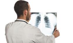Chronisch obstructief longlijden (COPD) verhoogt het risico op een plotse hartdood