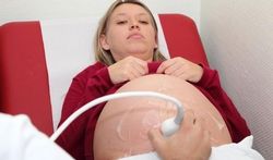 Vidéo - Qu'est-ce qu'une grossesse à risque ?
