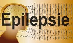 Slimme neurostimulator halveert aantal epilepsieaanvallen