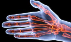 Nieuwe reuma-scanner voor opvolging reumatoïde artritis