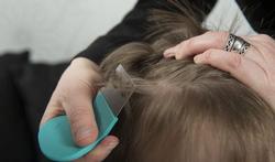 123-hoofdluizen-kam-haar-04-16.jpg