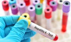 123-labo-hepatitisA-test-04-19.png