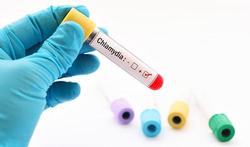 Online chlamydia thuistesten minder goed dan labtesten