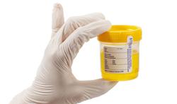 Analyse van urine toont risico op ouderdomsgerelateerde ziekten