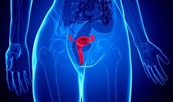 Cancer du col de l’utérus : 3 fiches d’information sur le dépistage