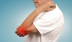 Reumatoïde artritis: snel behandelen