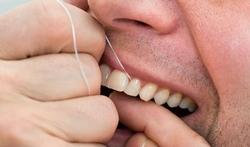 L’importance du fil dentaire, de la brossette ou du bâtonnet