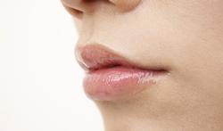 Quelles solutions contre les fissures aux coins des lèvres ?