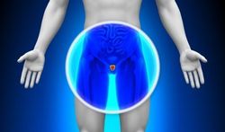 Cancer de la prostate : l’obésité est-elle un avantage ?