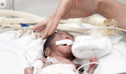 RSV-bronchiolitis gevaarlijk bij premature baby's