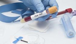 Cancer de la prostate : le test PSA fait-il plus de mal que de bien ?