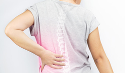 Osteoporose (botontkalking): symptomen, oorzaken en behandeling