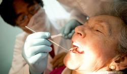 Wat zijn de symptomen van tandbederf en hoe kan je het voorkomen?