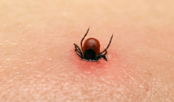 Ziekte van Lyme: hoe ernstig is een besmetting? 