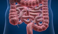 123-tek-darm-appendix-colon-170_05.jpg