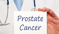 Prostaatkanker in woord en beeld