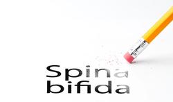 Mensen met spina bifida leven steeds langer