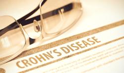 Welke factoren kunnen leiden tot de ziekte van Crohn en colitis ulcerosa?
