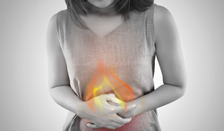 Brûlures d’estomac : les 5 conseils pour soulager le reflux