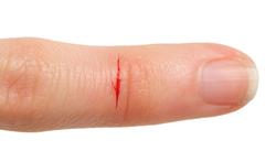 Waarom een paper cut zoveel pijn doet