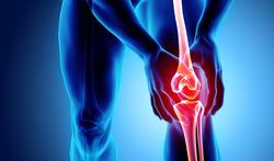 Wat zijn de mogelijke oorzaken van een gezwollen knie?