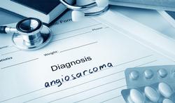 Hoe herken je een snelgroeiende tumor in bloed- of lymfevaten (angiosarcoom)?
