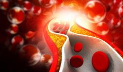 Risque cardiovasculaire : les statines plus efficaces avec des oméga-3