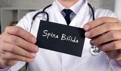 Spina bifida (open rug): oorzaak, symptomen en behandeling