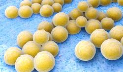 123h-staphylococcus-aureus-01-19.jpg