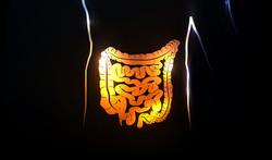 Vidéo - La maladie de Crohn