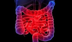 Graisses et antibiotiques : pourquoi les intestins souffrent