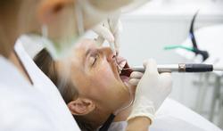 Nieuw advies van Hoge Gezondheidsraad om tandbederf te voorkomen