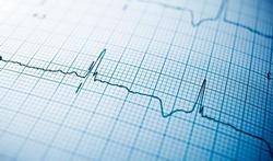 Virusmyocarditis of hartspierontsteking: symptomen en behandeling