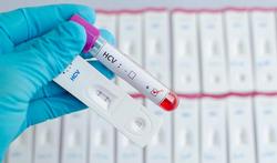 Vrijwilligers gezocht voor studie met Hepatitis B-vaccin