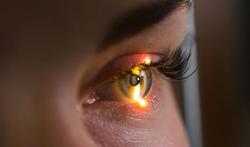 Getuigenis: Sofie liet haar ogen laseren (Lasik)