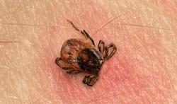 Morsure de tique : quel risque de maladie de Lyme ?